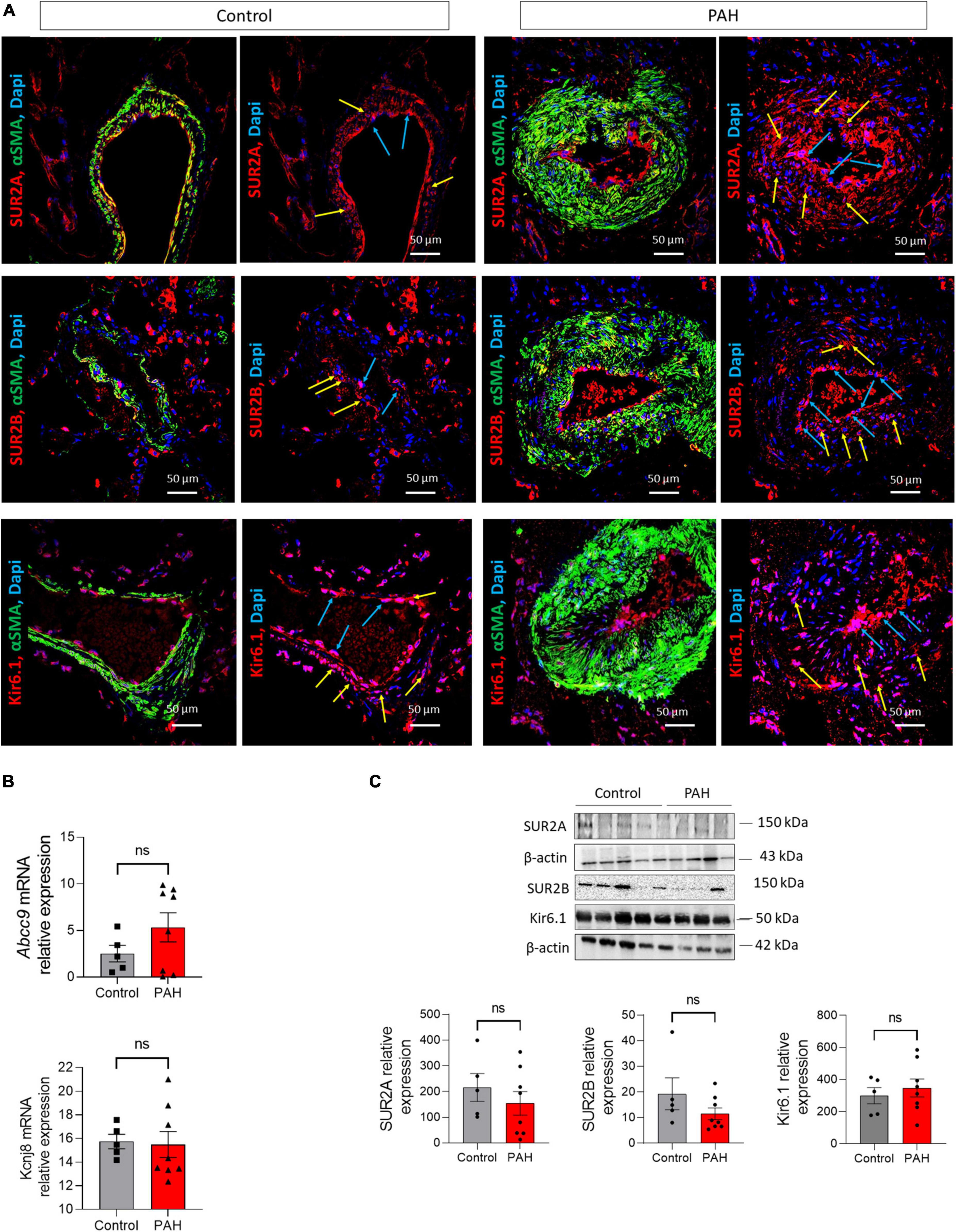 Involvement of SUR2/Kir6.1 channel in the physiopathology of pulmonary arterial hypertension